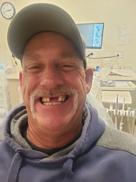 Patient missing front teeth