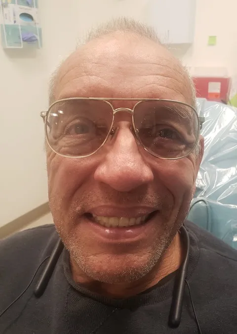 A patient smiling showing fixed teeth after dental treatment